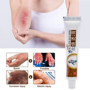 1Pcs Hua Tuo Oparine Zapiši Scar Removal Cream Lajšanje Bolečin Anti Vnetje Izboljšanje Celjenja Ran Analgetik Zeliščni Medicinske Mavca